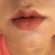 a10199411576CBD9B76